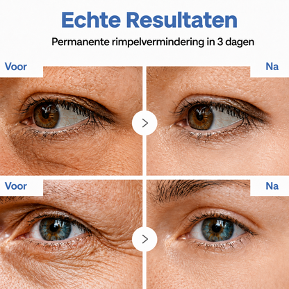 🪁💞𝐍𝐚𝐭𝐫𝐚𝐯𝐨𝐫® PDRN Anti-Rimpelverzorging – Liftende en Verstevigende Crème