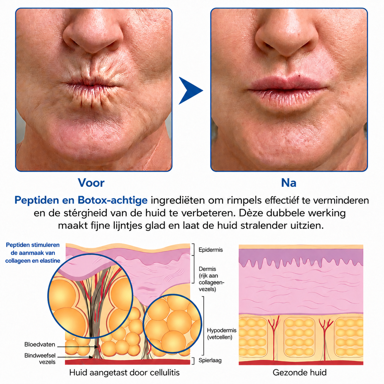 🪁💞𝐍𝐚𝐭𝐫𝐚𝐯𝐨𝐫® PDRN Anti-Rimpelverzorging – Liftende en Verstevigende Crème