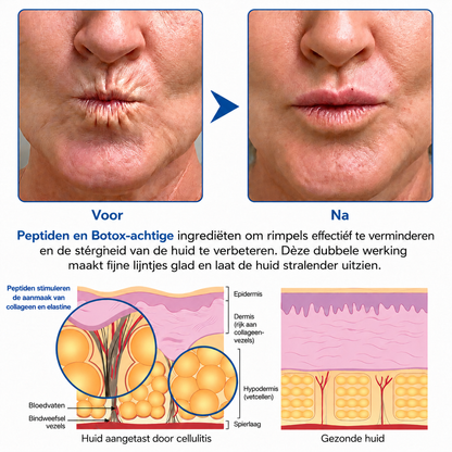 🪁💞𝐍𝐚𝐭𝐫𝐚𝐯𝐨𝐫® PDRN Anti-Rimpelverzorging – Liftende en Verstevigende Crème