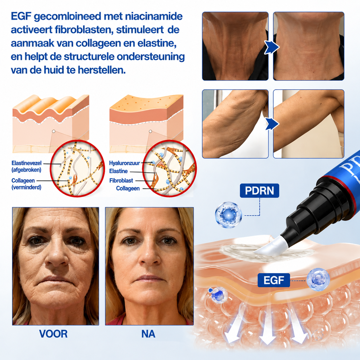 🪁💞𝐍𝐚𝐭𝐫𝐚𝐯𝐨𝐫® PDRN Anti-Rimpelverzorging – Liftende en Verstevigende Crème