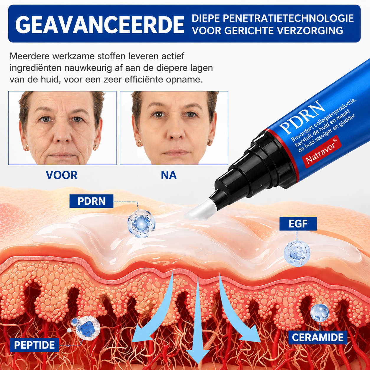 🪁💞𝐍𝐚𝐭𝐫𝐚𝐯𝐨𝐫® PDRN Anti-Rimpelverzorging – Liftende en Verstevigende Crème