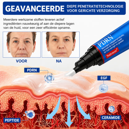 🪁💞𝐍𝐚𝐭𝐫𝐚𝐯𝐨𝐫® PDRN Anti-Rimpelverzorging – Liftende en Verstevigende Crème