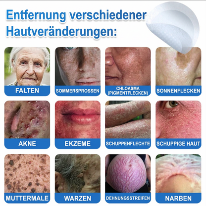 Officiële merkshop | 🎉 TopSpire® 2-in-1 Micro-naald & Hydrocolloïde Pleisters | Voor verheven moedervlekken, acne, platte wratten & huidaanhangsels
