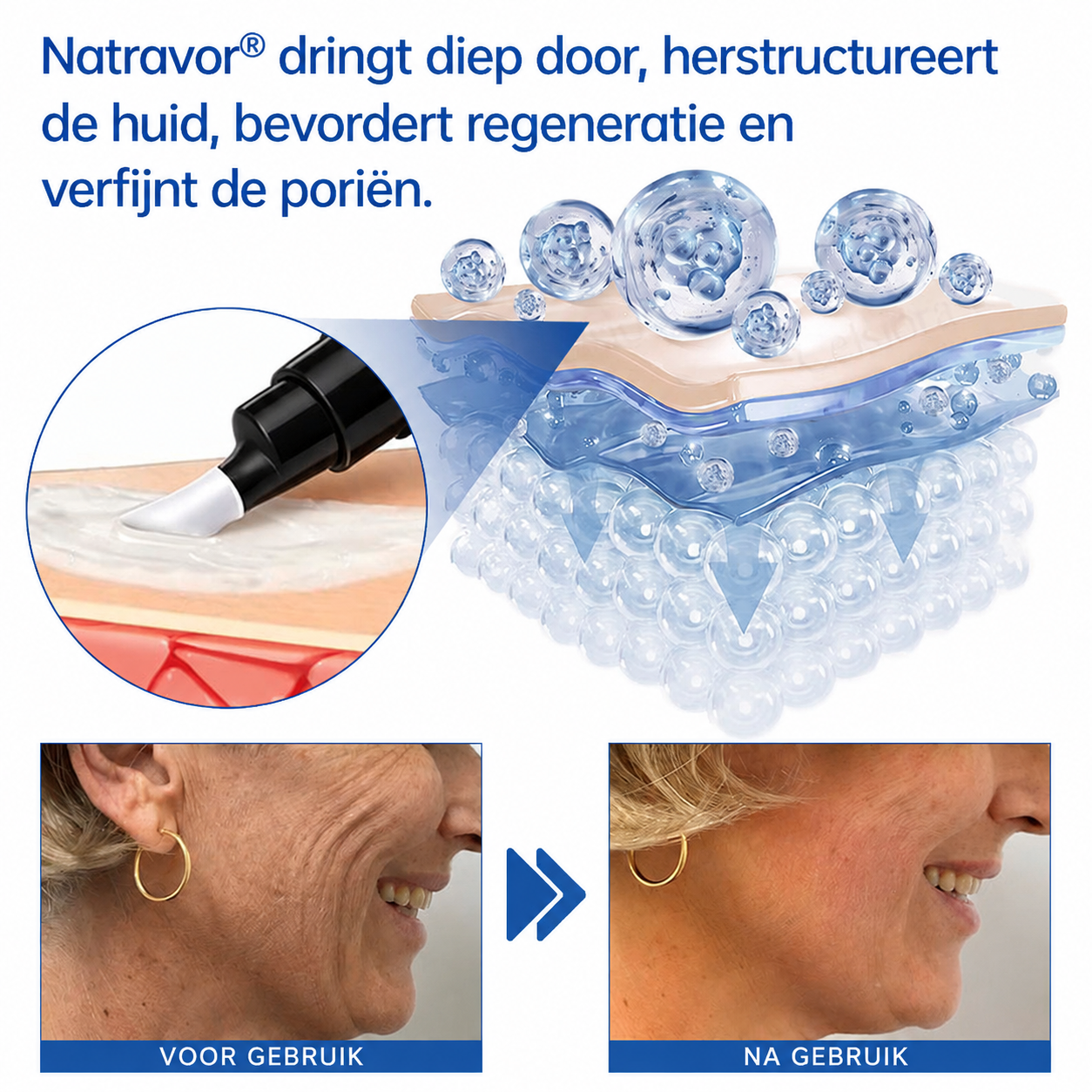 🪁💞𝐍𝐚𝐭𝐫𝐚𝐯𝐨𝐫® PDRN Anti-Rimpelverzorging – Liftende en Verstevigende Crème