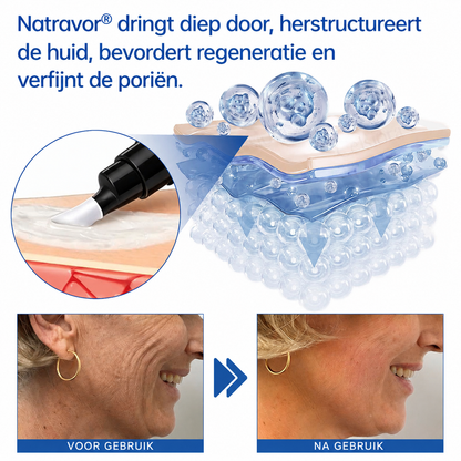 🪁💞𝐍𝐚𝐭𝐫𝐚𝐯𝐨𝐫® PDRN Anti-Rimpelverzorging – Liftende en Verstevigende Crème