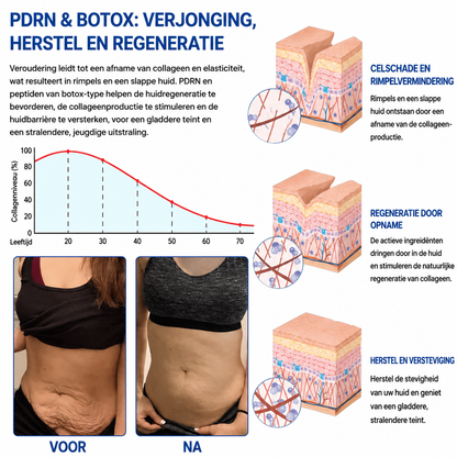 🪁💞𝐍𝐚𝐭𝐫𝐚𝐯𝐨𝐫® PDRN Anti-Rimpelverzorging – Liftende en Verstevigende Crème