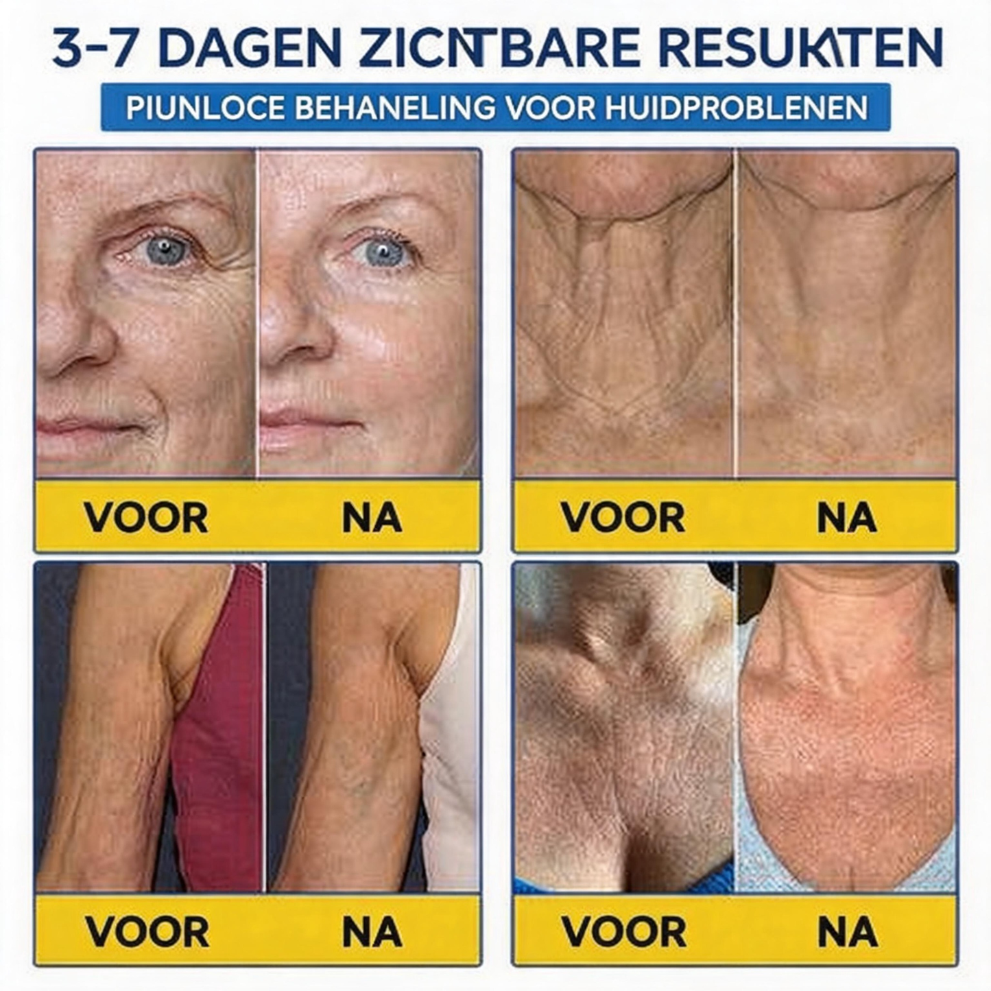 🪁💞𝐍𝐚𝐭𝐫𝐚𝐯𝐨𝐫® PDRN Anti-Rimpelverzorging – Liftende en Verstevigende Crème
