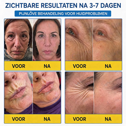 🪁💞𝐍𝐚𝐭𝐫𝐚𝐯𝐨𝐫® PDRN Anti-Rimpelverzorging – Liftende en Verstevigende Crème
