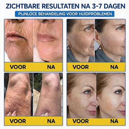 🪁💞𝐍𝐚𝐭𝐫𝐚𝐯𝐨𝐫® PDRN Anti-Rimpelverzorging – Liftende en Verstevigende Crème